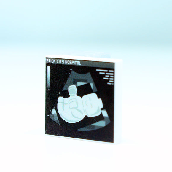 2x2 Sonogram